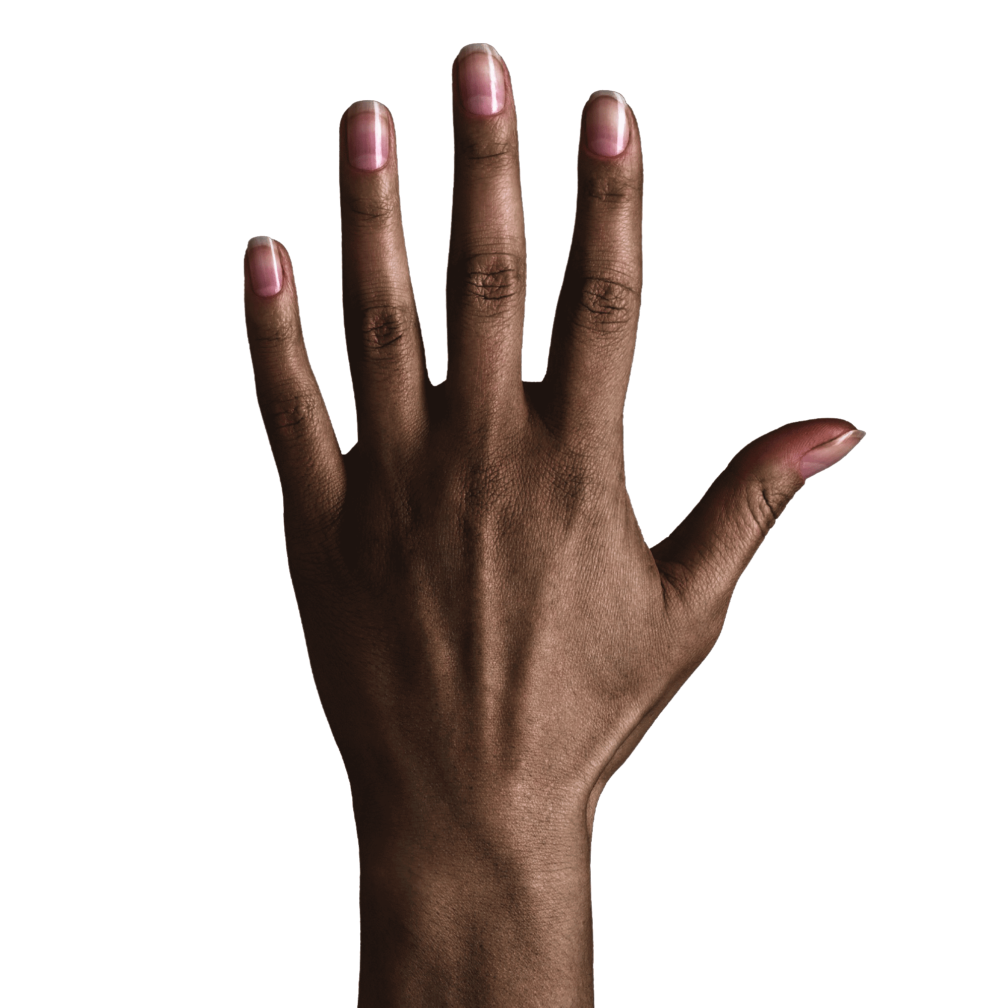dunklerer Hautton der Hand